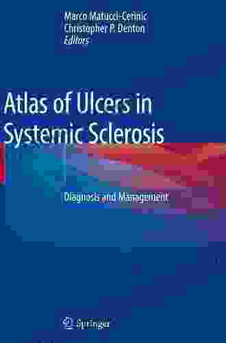 Atlas Of Ulcers In Systemic Sclerosis: Diagnosis And Management