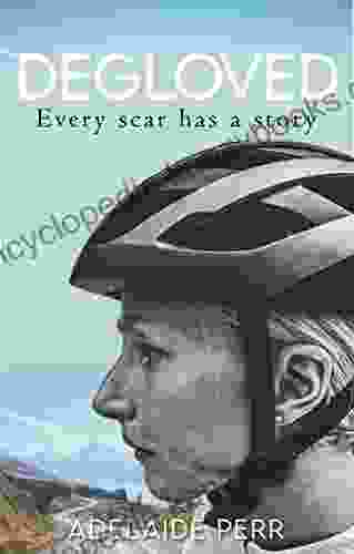 Degloved : Every Scar Has A Story