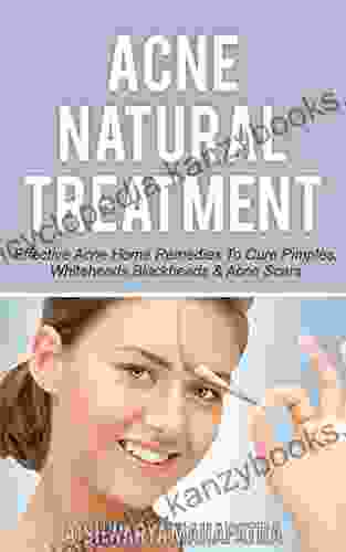 Acne Natural Treatment: Effective Acne Home Remedies To Cure Pimples Whiteheads Blackheads Acne Scars