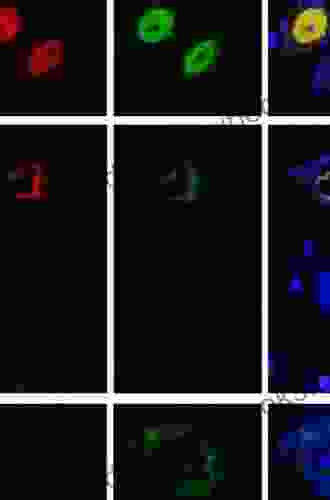 Parkinson S Disease: Molecular Mechanisms Underlying Pathology